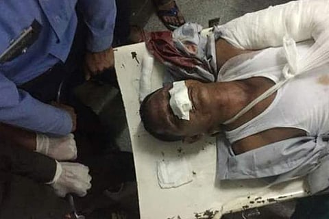 One of the Amarnath Yatra victim at the hospital (Photo: ANI)