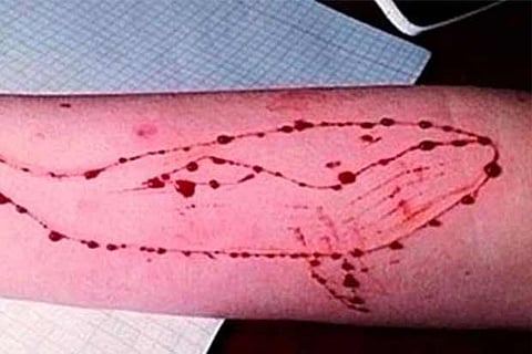 File photo of self-inflicted injuries on the arm of a player