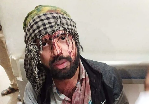 Sandip was injured during the scuffle and then admitted to the Safdarjung Hospital later (Pic: JNUSU)