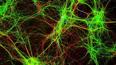 ಬಣ್ಣದ ಪ್ರೊಟೀನು ತಯಾರಿಸಿದ ನರಗಳು