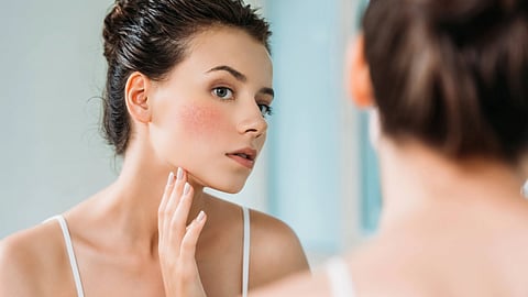Sensitive Skin Care: Is Your Skin Sensitive Too? Here’s What You Should Know