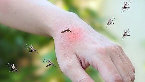 Monsoon Health Tips: How to Protect Yourself from Dengue This Rainy Season