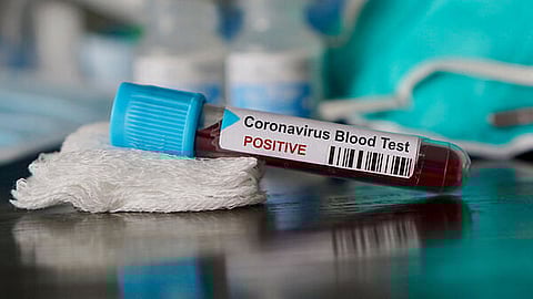 12 BSF personnel posted in Tripura test positive for COVID-19