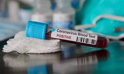 Total coronavirus positive cases rise to 40,263 in India