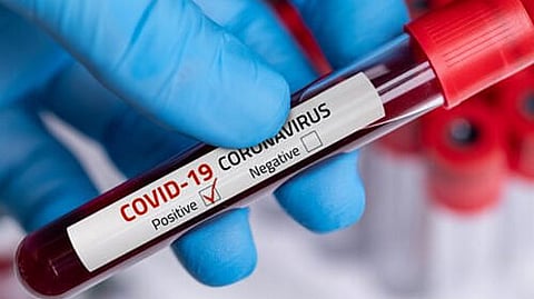 4 more people including a doctor from Guwahati found COVID positive, total cases 53 in Assam