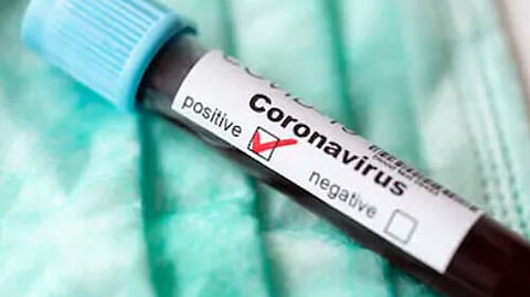 Tripura COVID-19 Positive Cases Rise to 118; 30 more tests Positive