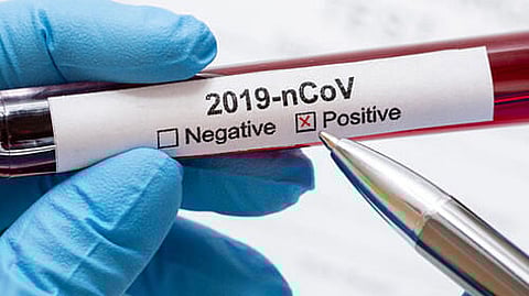 Assam COVID-19 Positive Cases Rise to 59; One more tests Positive