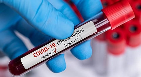 Anxiety among staff of Air India, as five pilots test positive for Coronavirus