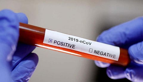 Woman tests COVID negative after fifth analysis in Meghalaya