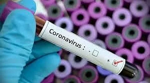 7 BSF men among 11 test COVID positive in Tripura after 48 hours