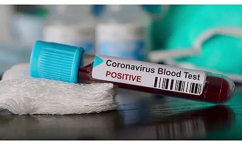 One from Dibrugarh district tests COVID-19 positive