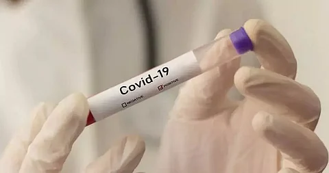 Khasi Students Union wants coronavirus testing along with Indo-Bangla border areas