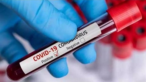 Two persons from Hailakandi test COVID-19 positive