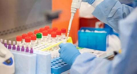 Arunachal Cabinet decides to outsource COVID-19 testing samples