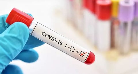 18 persons in Golaghat district test positive for COVID-19