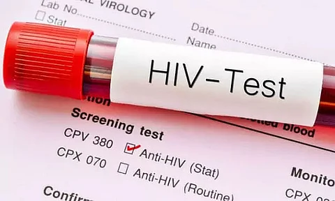 Arunachal Pradesh records 434 HIV/AIDS positive cases in 2019