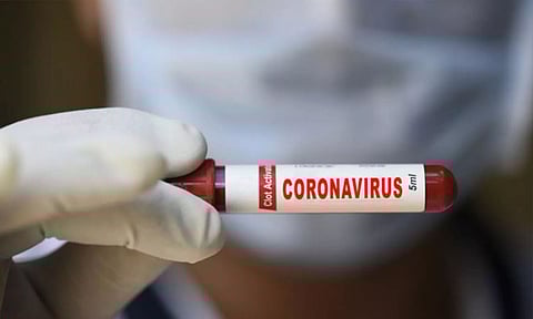 Representational Image