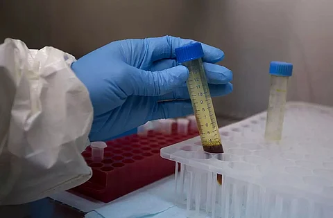 Self-swabbing tests for COVID accurate and safe: Study