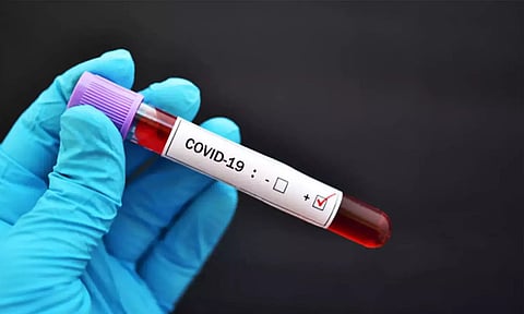 Nagaland registers 9 more Covid-19 positive cases, total 177