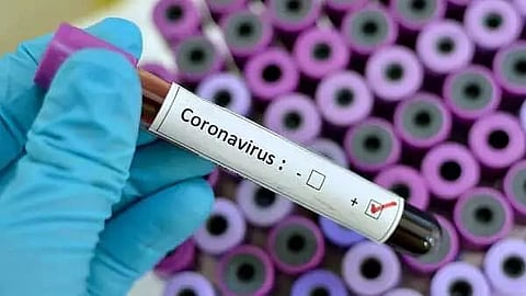 One more test COVID positive in Meghalaya