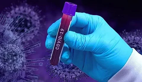 Six more tests COVID-19 positive in Golaghat