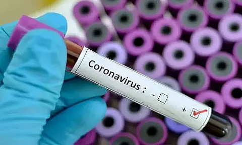 On-duty nurse tests positive for Covid-19 in Dhemaji
