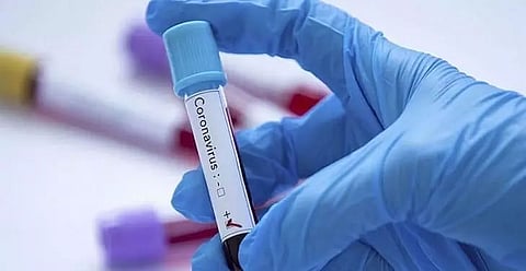 SSB personnel tests COVID-19 positive in Lakhimpur district