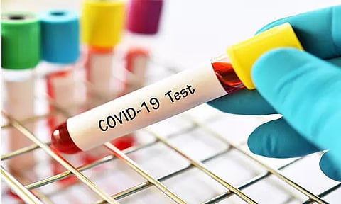 19 test COVID positive in building sheltering SBI, 108 offices