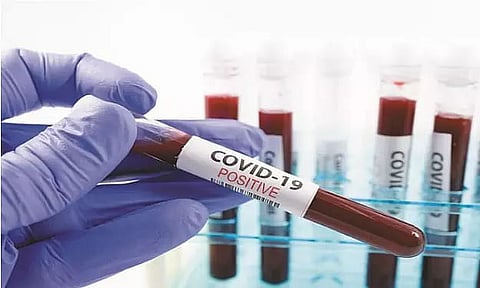 One tested positive for COVID-19 in Sivasagar