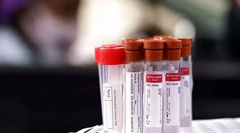 Three more BSF personnel test COVID-19 positive in Meghalaya