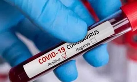 One more BSF jawan tests COVID-19 positive in Meghalaya