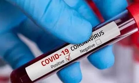 Nagaland registers 11 more COVID-19 positive cases, total 743