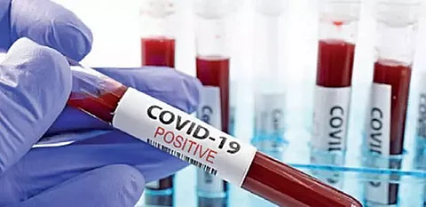 Five COVID-19 positive cases detected in Lakhimpur; total tally 345