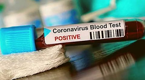 Arunachal Pradesh: 63,784 samples tested for COVID-19