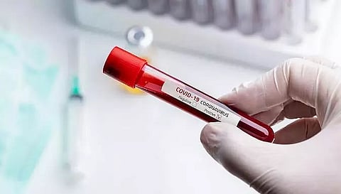 NABARD accelerates livelihood generation programmes to tackle COVID-19 pandemic