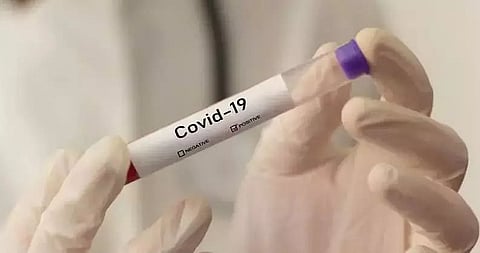 Two doctors tested COVID-19 positive in Demow