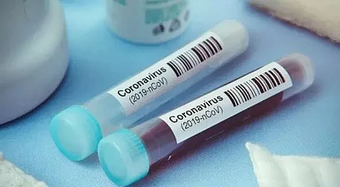 Meghalaya corona cases rise to 594; 423 patients recover till date