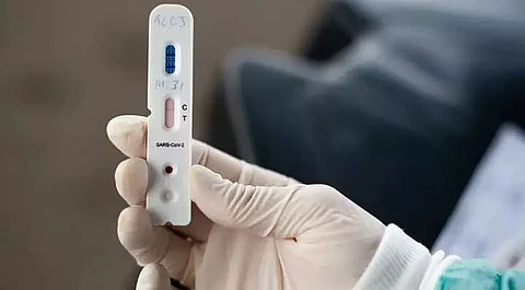 RT-PCR tests initiated by health department begin for teachers in Jamugurihat
