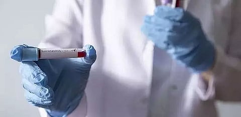 COVID warriors in Health & Police departments test COVID positive in Mangaldai