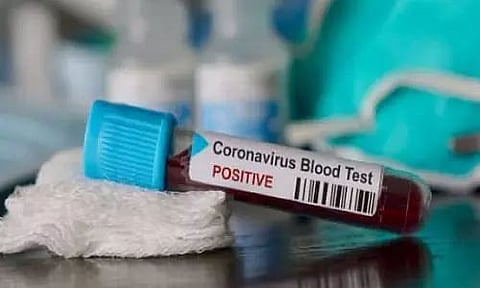 Private hospital reports first case of coronavirus reinfection in Bengaluru