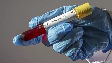 127 new COVID-19 cases in Arunachal; Total tally reaches 5,672