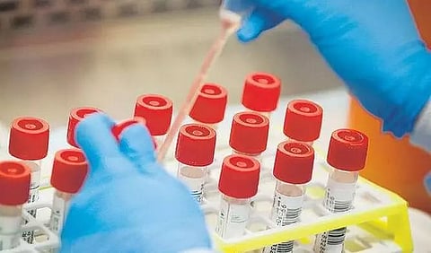 Arunachal's COVID tally rises to 7,595 as 210 more persons test positive