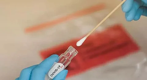 Assam corona positive cases rise to 1,88,902