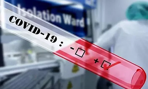 Arunachal reports 165 new COVID-19 cases taking the total tally to 14,077