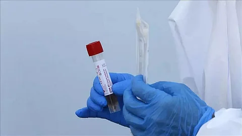 71 COVID-19 patients recover in Arunachal Pradesh