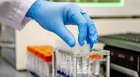 India Corona curve: 41,322 new cases reported in the past 24 hours