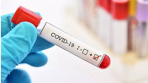 Arunachal Pradesh COVID tally rises to 16,262