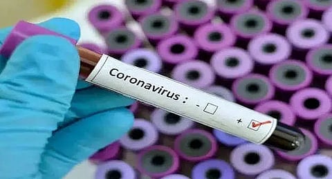 Para-athletics coach Gajender tests positive for novel coronavirus