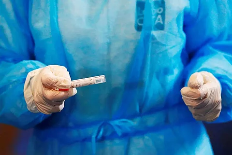 72 COVID-19 patients recover in Meghalaya