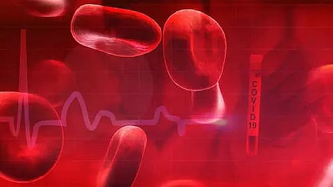 Secondary bloodstream infections linked to severe COVID-19